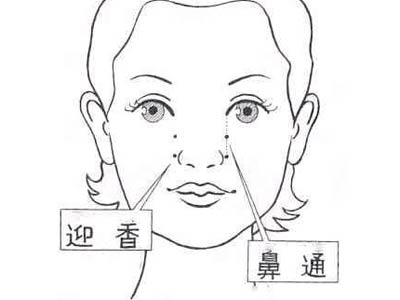 过敏性鼻炎之针灸疗法
