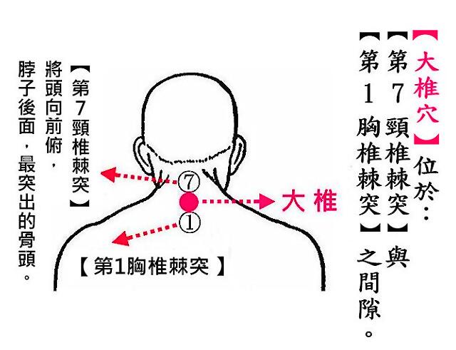 大椎穴.jpg