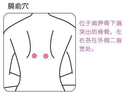 肺炎之拔罐疗法