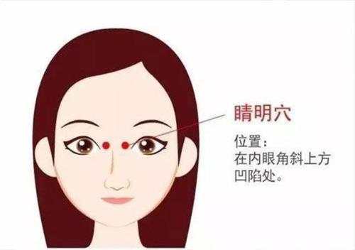 睛明穴.jpg