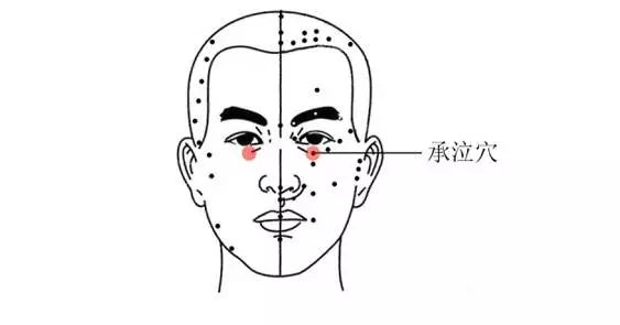 承泣穴.jpg