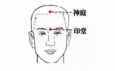 神庭穴.jpg