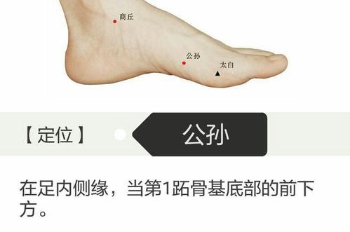 暑湿郁表型中暑针灸疗法