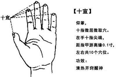 暑犯心包型中暑针灸疗法