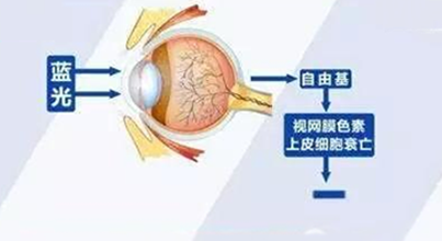 叶黄素对眼睛的五大保护作用