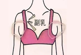 产后副乳的原因及解决办法