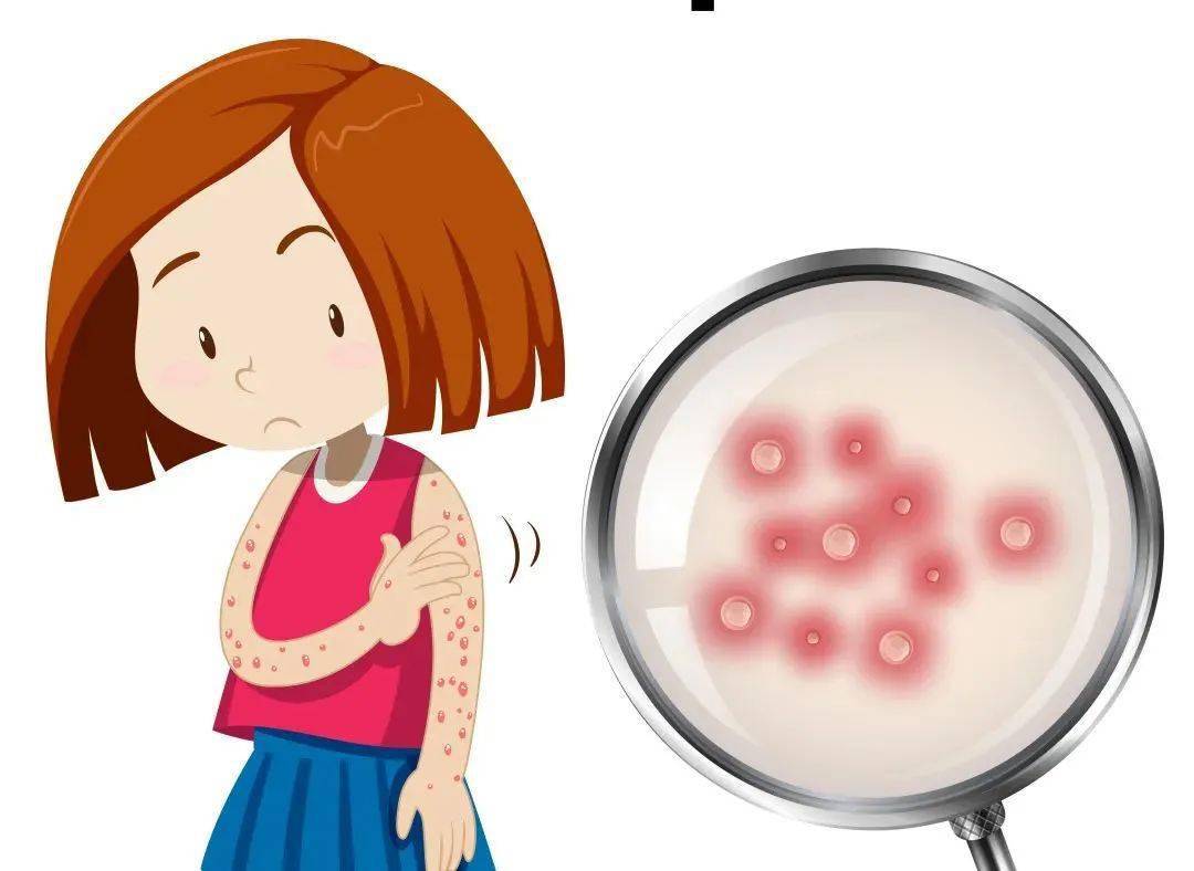 宝宝水痘症状图片有哪些（这种疹子传染性加强，日常预防家长要这样做） | 说明书网