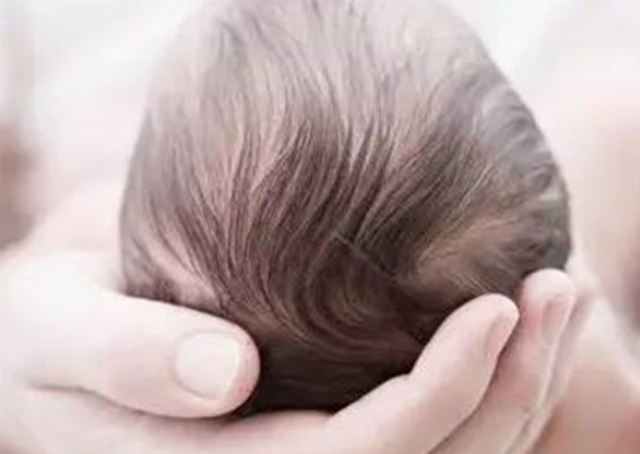 婴幼儿护理头发