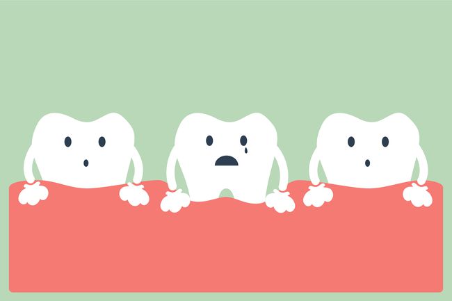 牙齿松动是病理性的