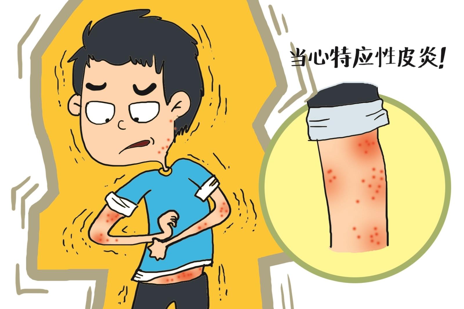 炎炎夏日来临，极容易忽视的4类皮炎，看过的人早预防