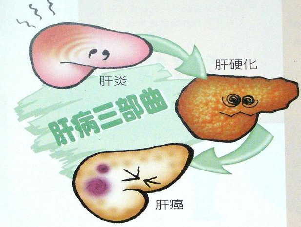 肝炎导致甲胎蛋白升高