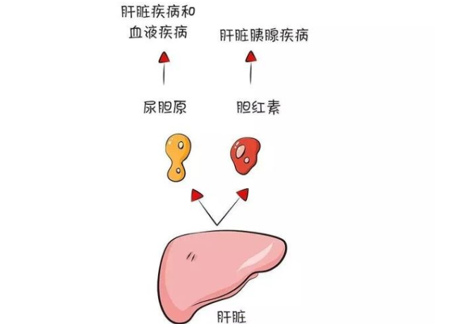 尿胆原升高与肝脏