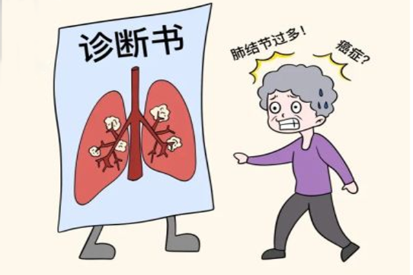 肺结节是肺癌吗