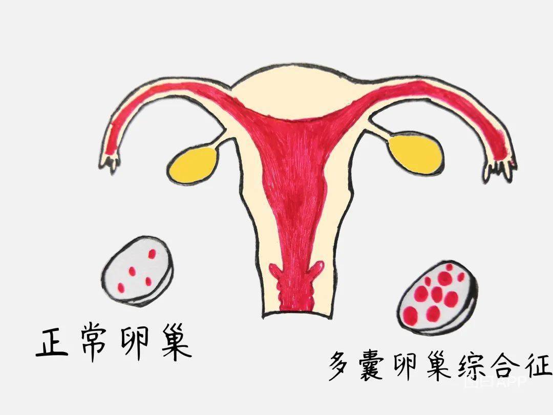 图6-2 正常卵巢声像图-临床医学-医学