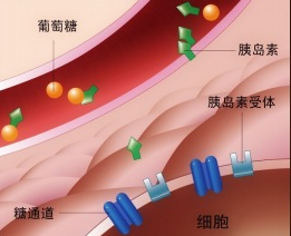 胰岛素分泌不足