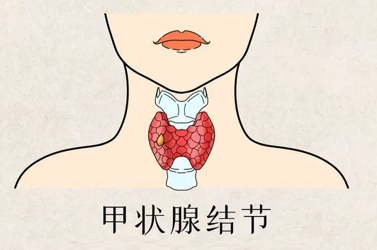 甲状腺