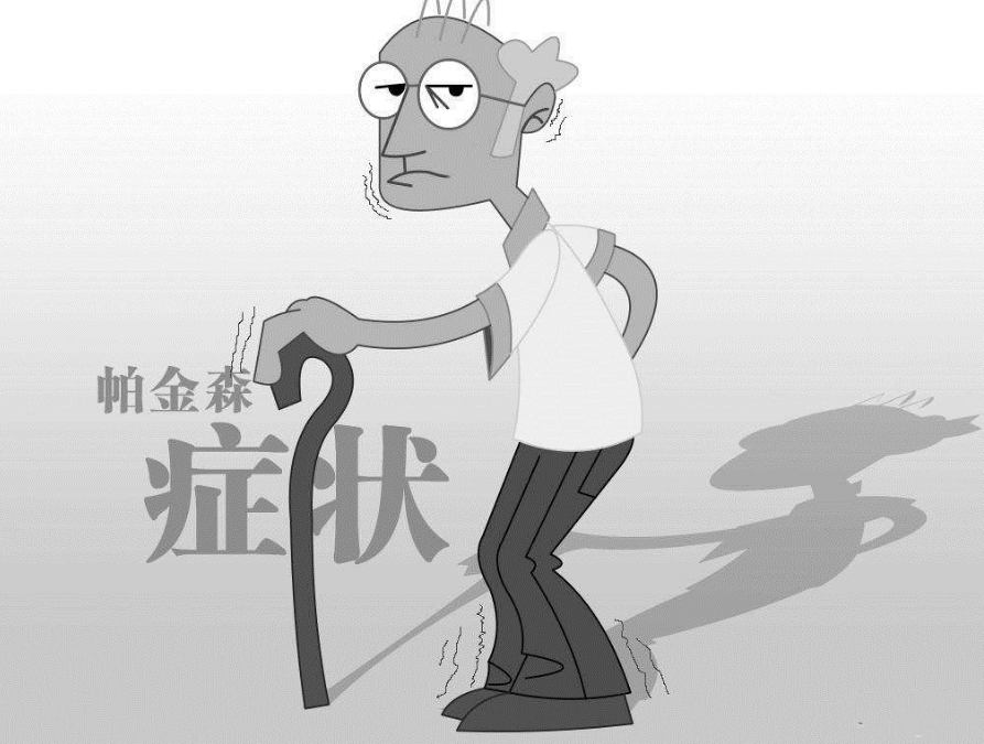 帕金森典型的静止性震颤
