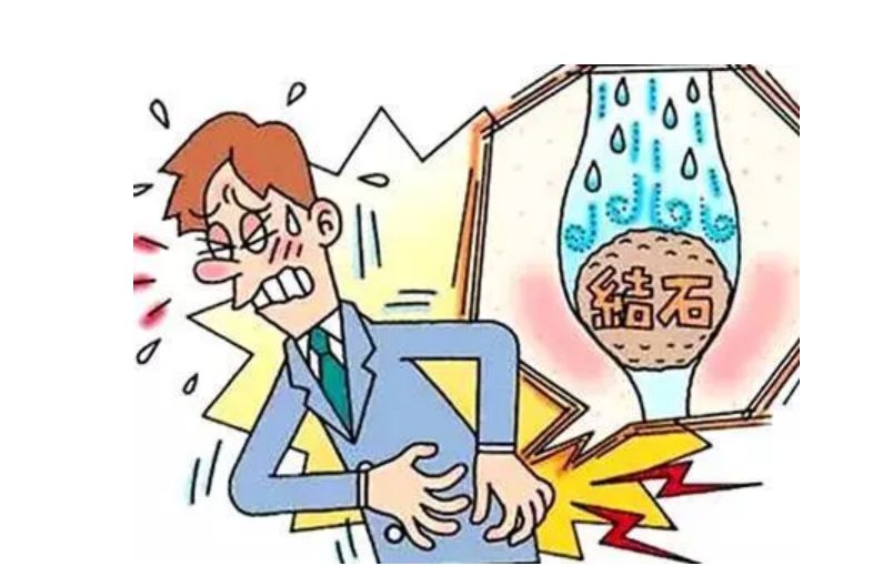 肾结石诱因