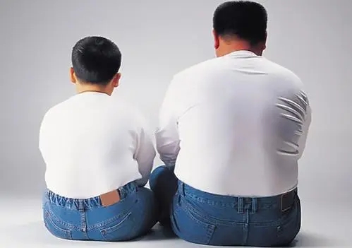 肾结石与肥胖
