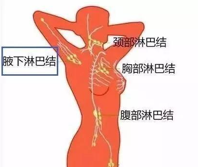 淋巴结布边全身