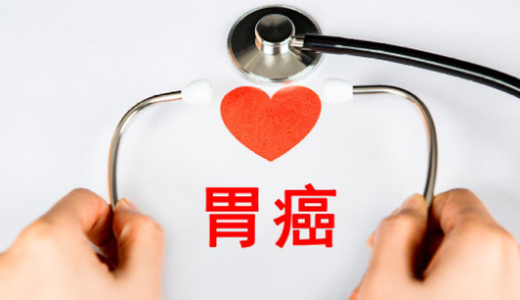胃癌治愈性大