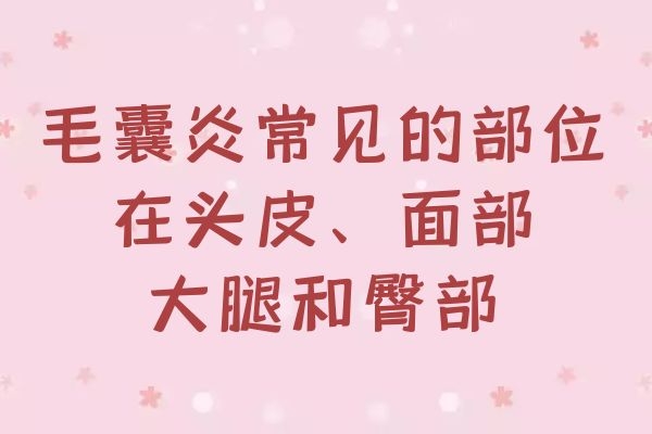 毛囊炎常见部位