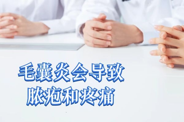 脓疱疼痛